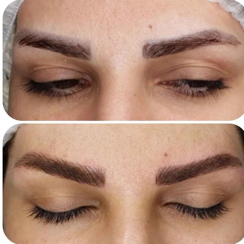 میکروبلیدینگ ابرو